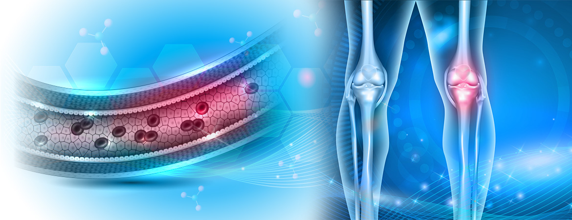 The important role of vitamin K beyond clotting